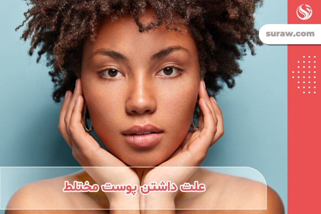 3 علت اصلی داشتن پوست مختلط + نحوه مراقبت از این نوع پوست