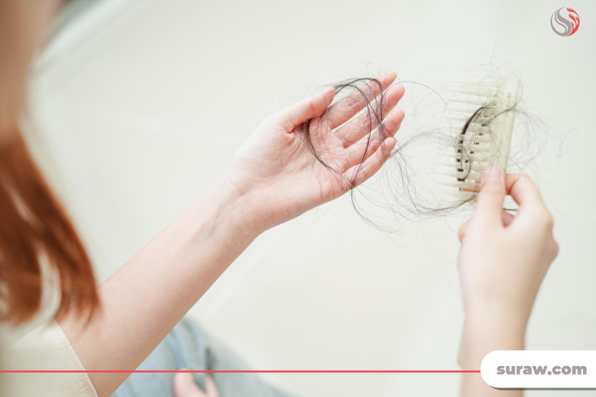 علت ریزش مو در زنان کمبود چه ویتامینی است؟