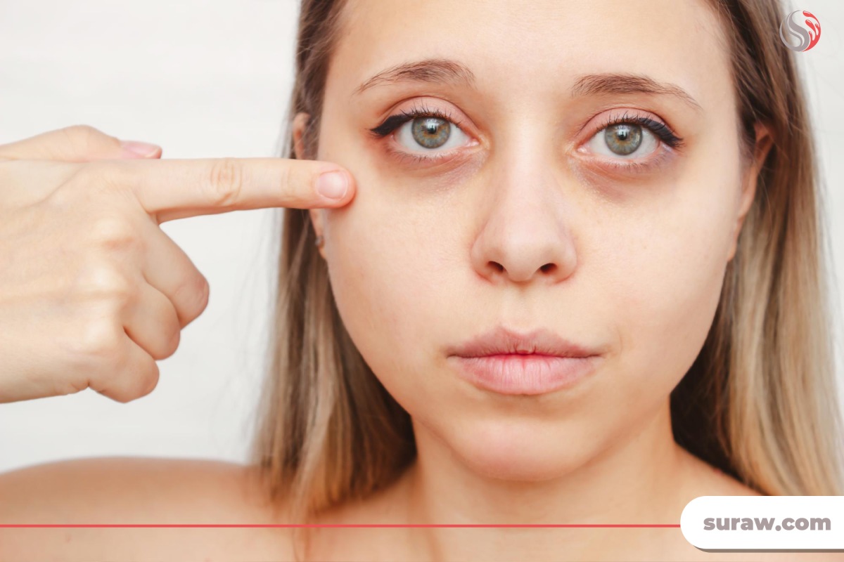 آیا کرم های دور چشم برای کاهش تیرگی و پف زیر چشم موثر هستند؟