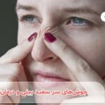 جوش های سر سفید بینی