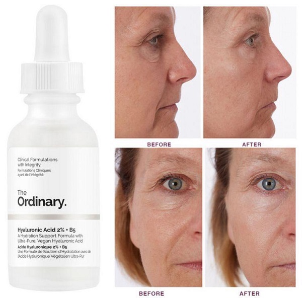 The Ordinary Hyaluronic Acid 2% + B5 Hydration Support Formula (6)