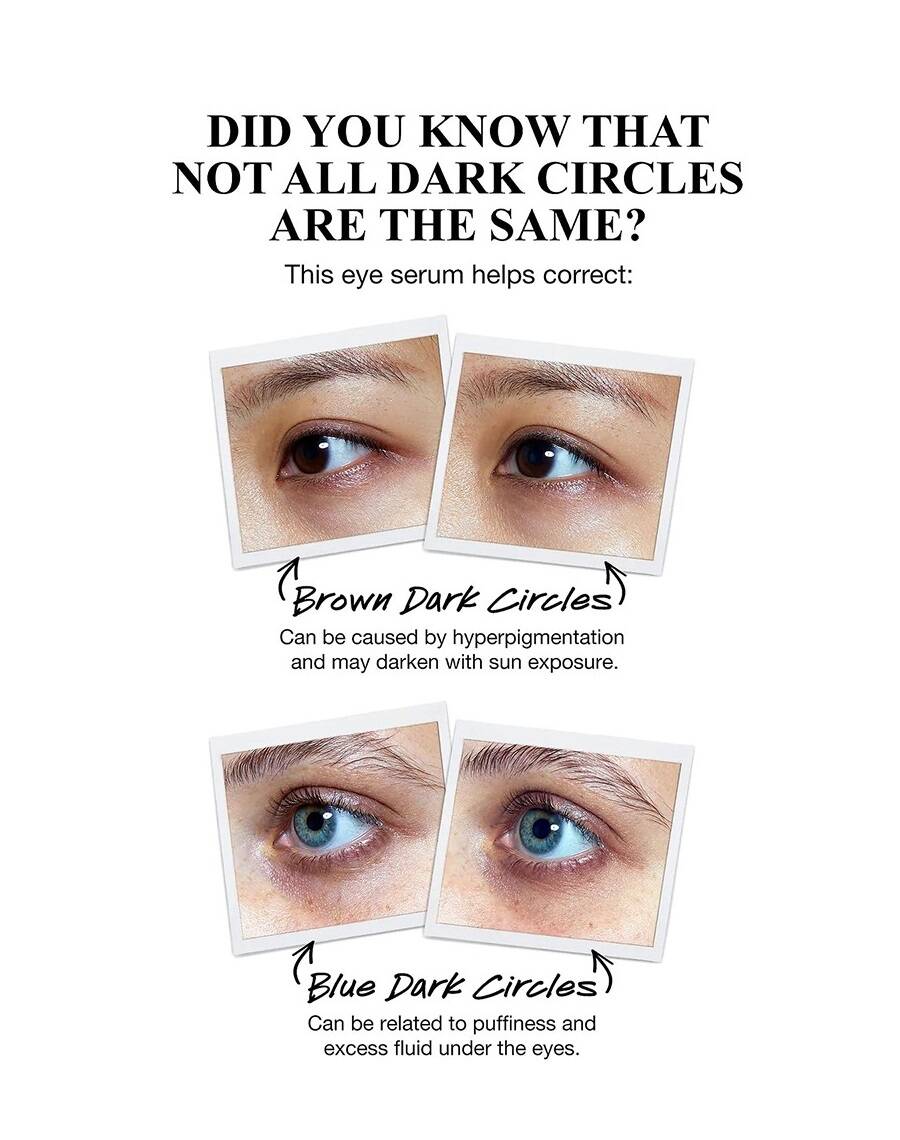 سرم دور چشم ویتامین سی کیلز (کرم دور چشم روشن کننده و ضدچروک ویتامین C کیلز) - Kiehl's Powerful-Strength Line-Reducing & Dark Circle-Diminishing Vitamin C Eye Serum 15ml