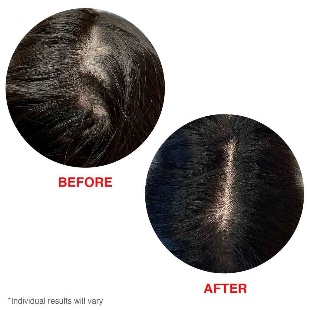 قبل و بعد استفاده از سرم موی اسکالپ هیر تامین