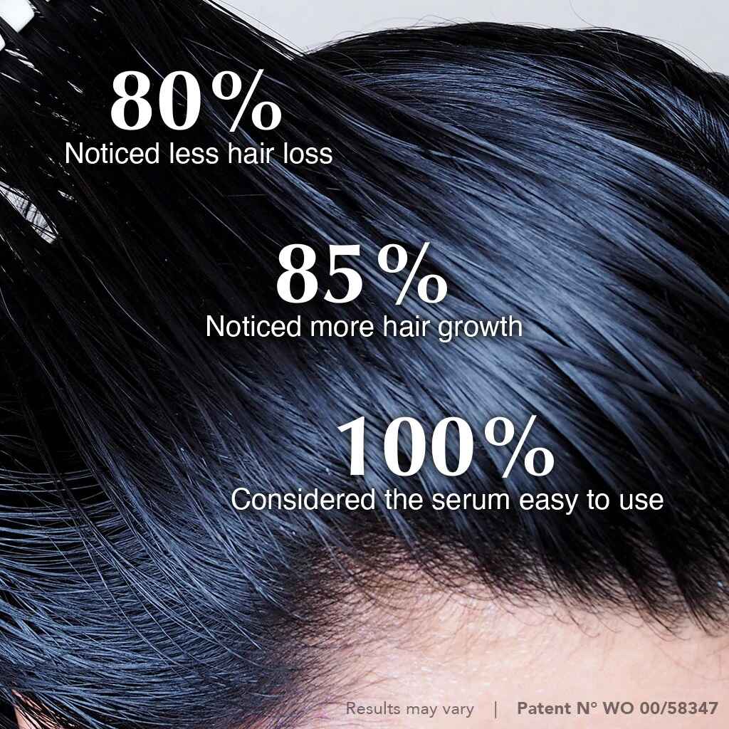 اثرات سرم اسکالپ Hairtamin برای درمان ریزش موها